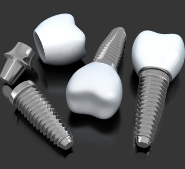 Three animated dental implant supported replacement teeth