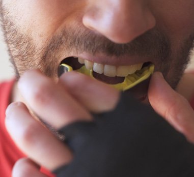 man wearing mouthguard for dental implant care in Daniel Island